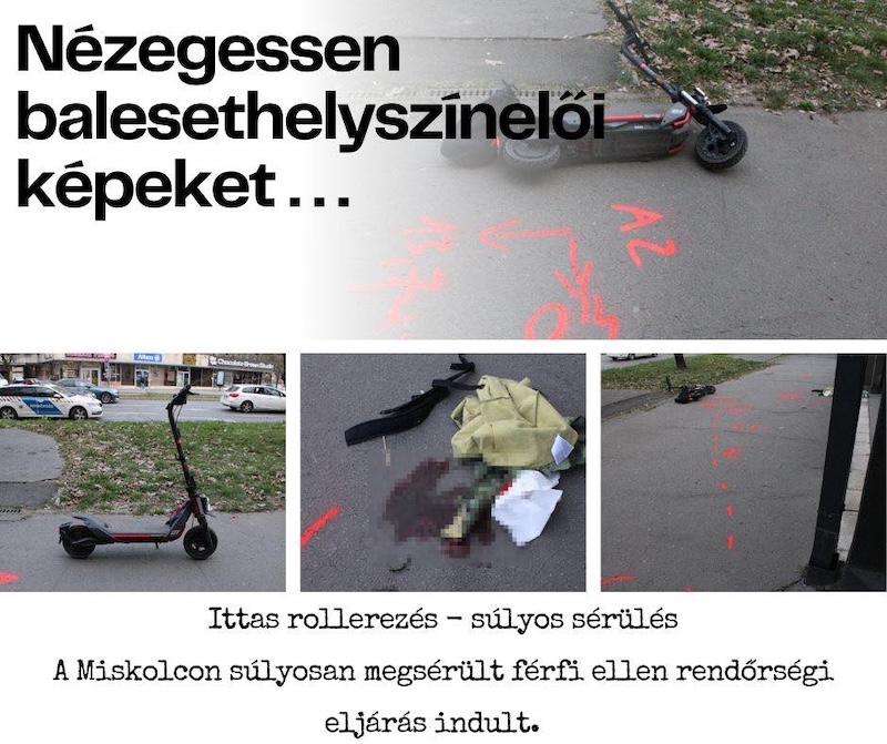 Részegen rollerezett, súlyosan megsérült – eljárás indult a miskolci férfi ellen